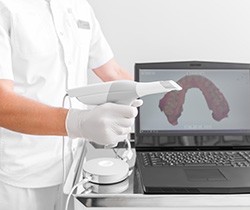 digital impressions for implant restoration 